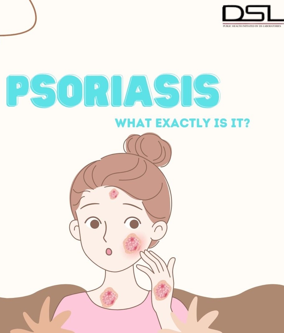 PSORIASIS: WHAT EXACTLY IS IT?