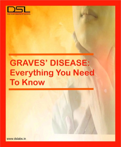 GRAVES’ DISEASE